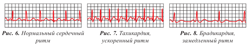 Механические колебания и волны в физике - формулы и определение с примерами