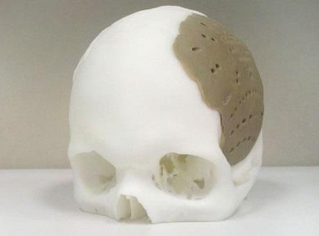 череп 3d  принтер